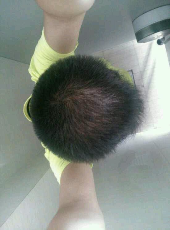 ”【成长记录】戒色之头发恢复篇