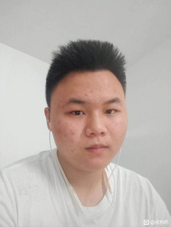 ”sy他伤的很全面，他不单单只是一个方面，他是整体的损害