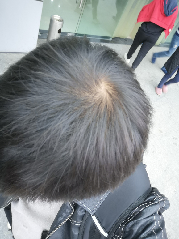 ”戒色77天，就昨天遗精一次，内裤都湿了，是不是精满？？