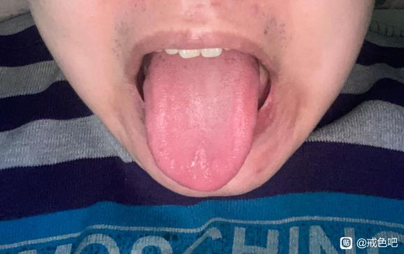 ”请问这种情况该吃哪种药调理