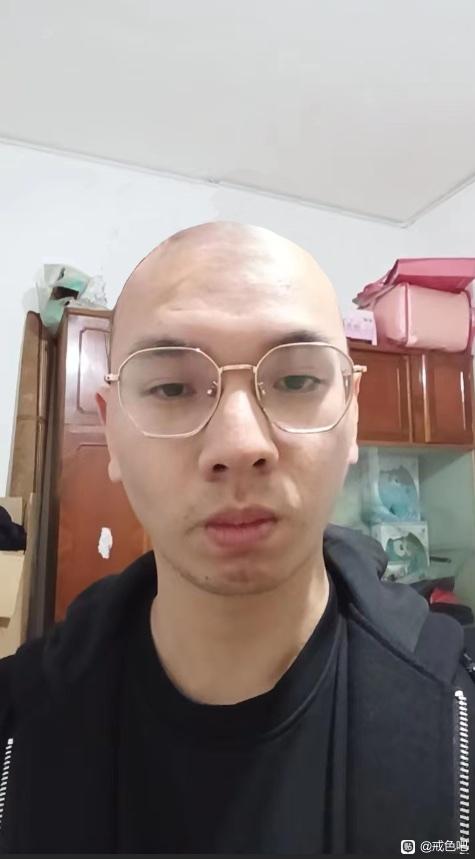 ”感恩，戒色之后脱发问题解决