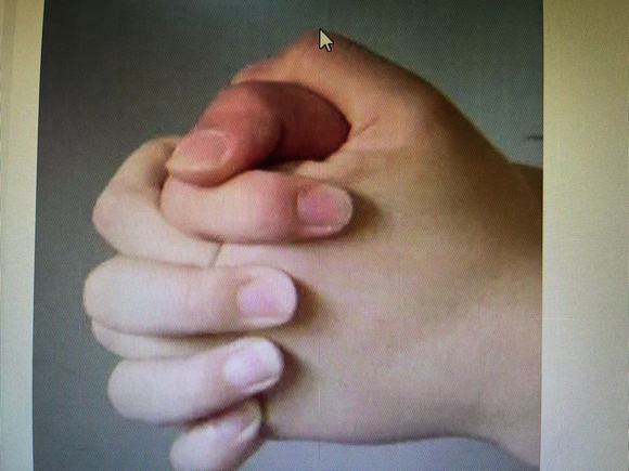 ”戒除手淫物理小妙招