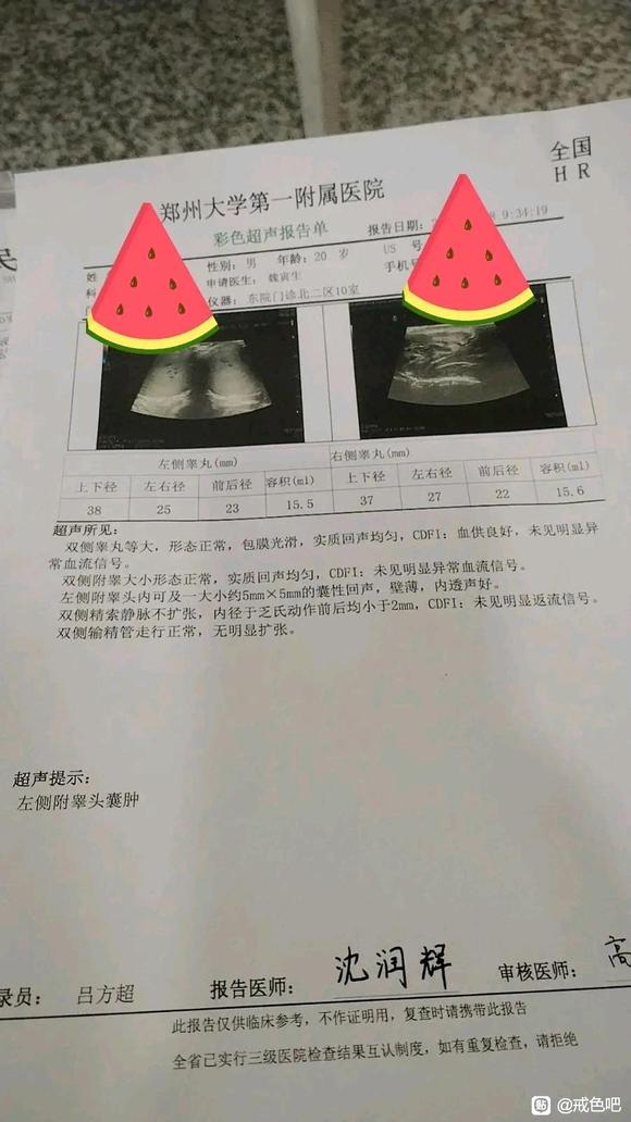 ”破戒导致附睾炎复发