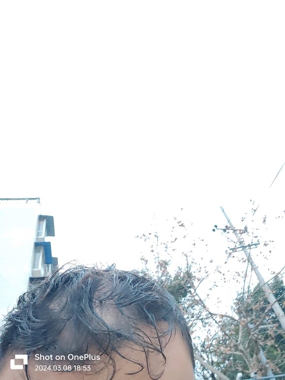 ”戒色真的可以恢复头发吗兄弟们