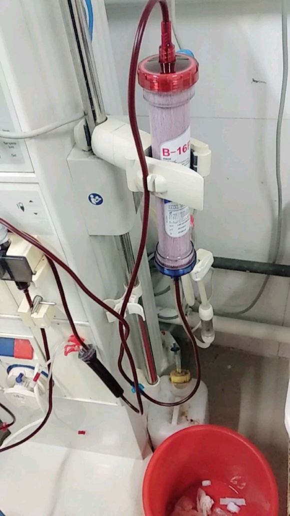 ”你还敢撸吗？你不怕吗？又一个尿毒症晚期患者，诞生了，醒醒吧，