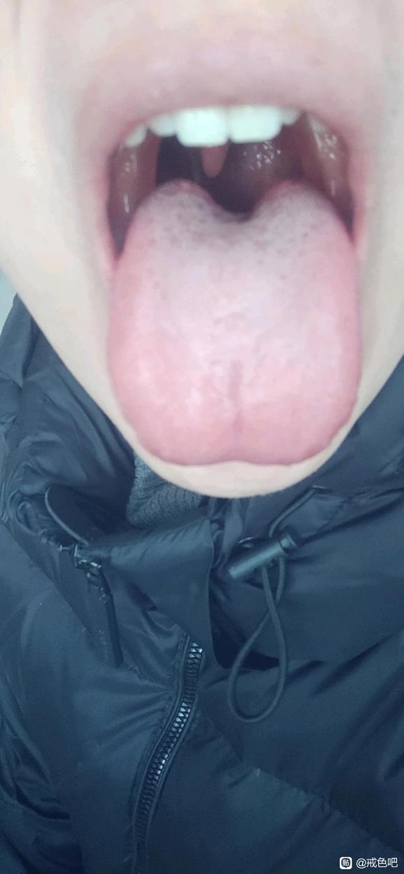 ”明天开始艾灸关元穴