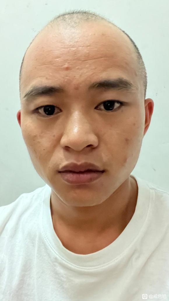 ”手淫这么多年的差别，前后对比照片，