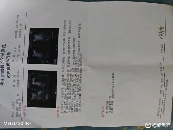 ”肾囊肿的朋友进来看看，能帮到一个是一个