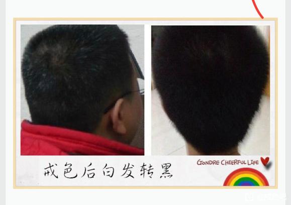 ”前辈有没有戒了之后头发恢复乌黑亮丽的案例