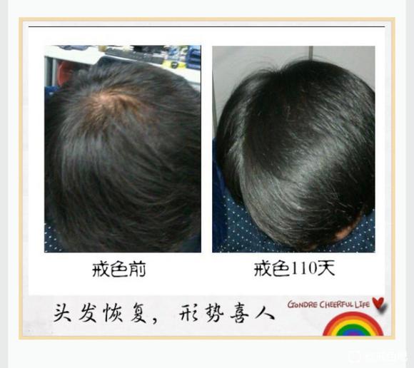 ”前辈有没有戒了之后头发恢复乌黑亮丽的案例