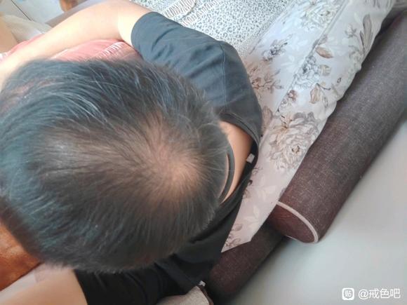 ”戒色前后，头发恢复对比