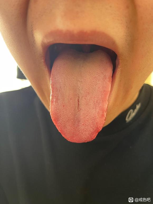 ”感觉自己早泄，也快阳痿了