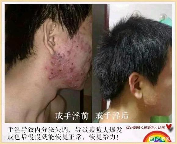 ”百位戒友戒色前后对比图（必看）