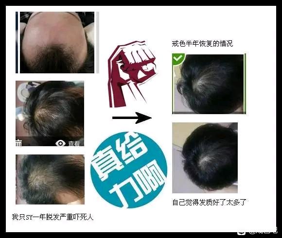 ”百位戒友戒色前后对比图（必看）