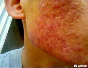 ”老铁们还有救吗？？？？是不是需要戒色啊