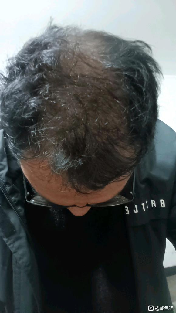 ”#微信看病卖药是假的#天天打✈，身体虚的不行咋办呀