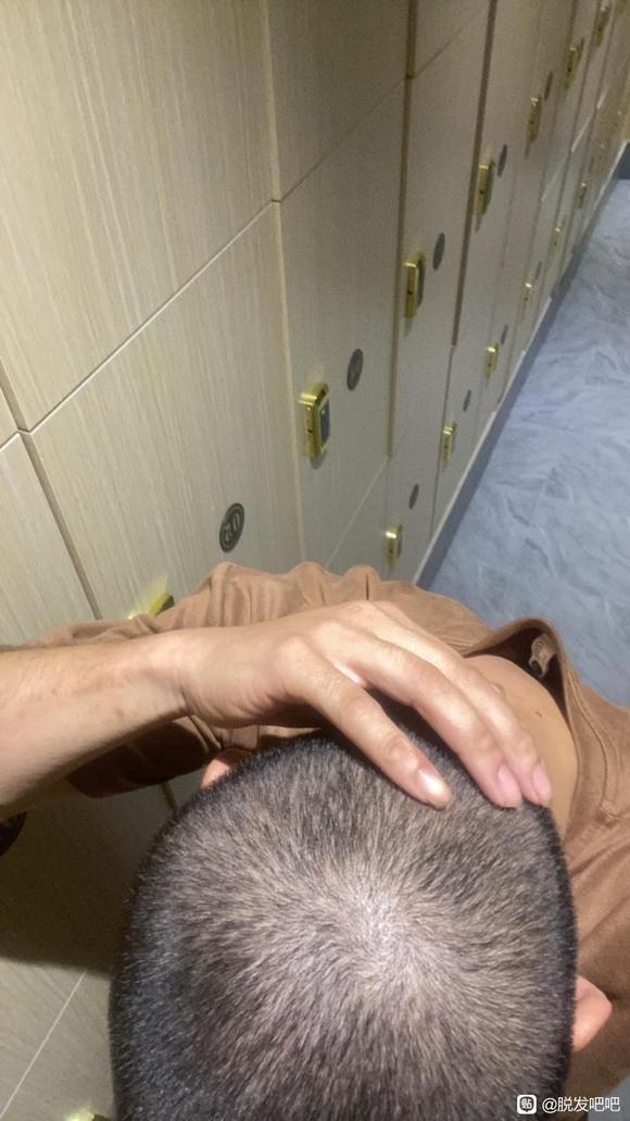 ”努力戒色想要恢复以前的头发，心累啊