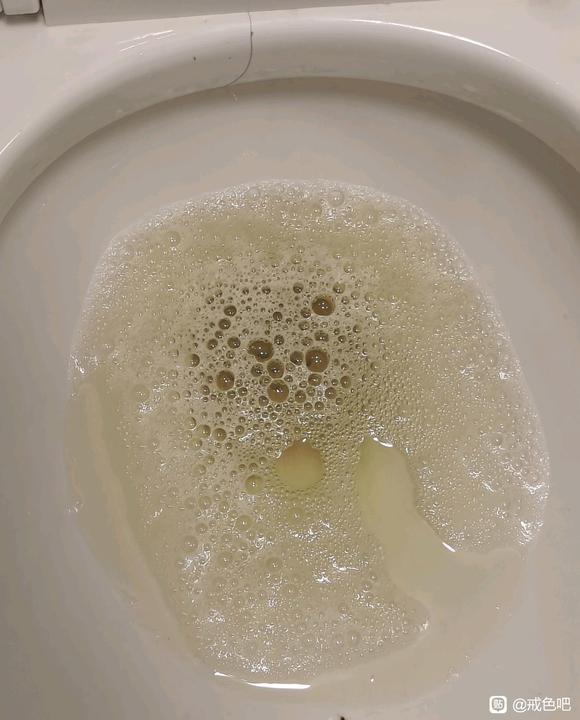 ”手艺引起肾炎