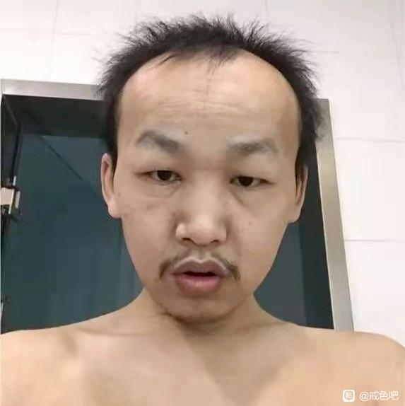 ”大家不要在手淫了，在手淫会变成这样