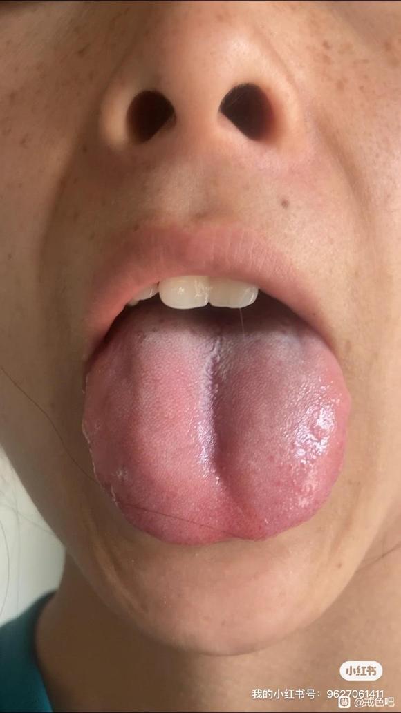 ”脾虚恢复之路