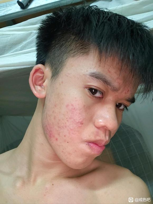 ”【成长记录】太难戒了，48天没了，又破了