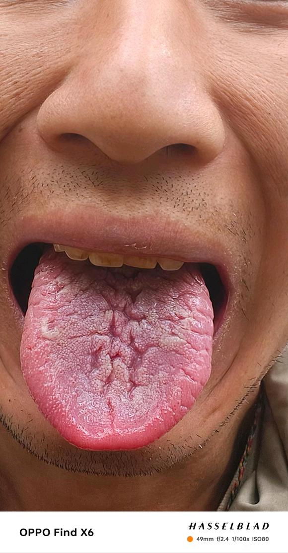 ”#微信看病卖药是假的#各位大神救救我