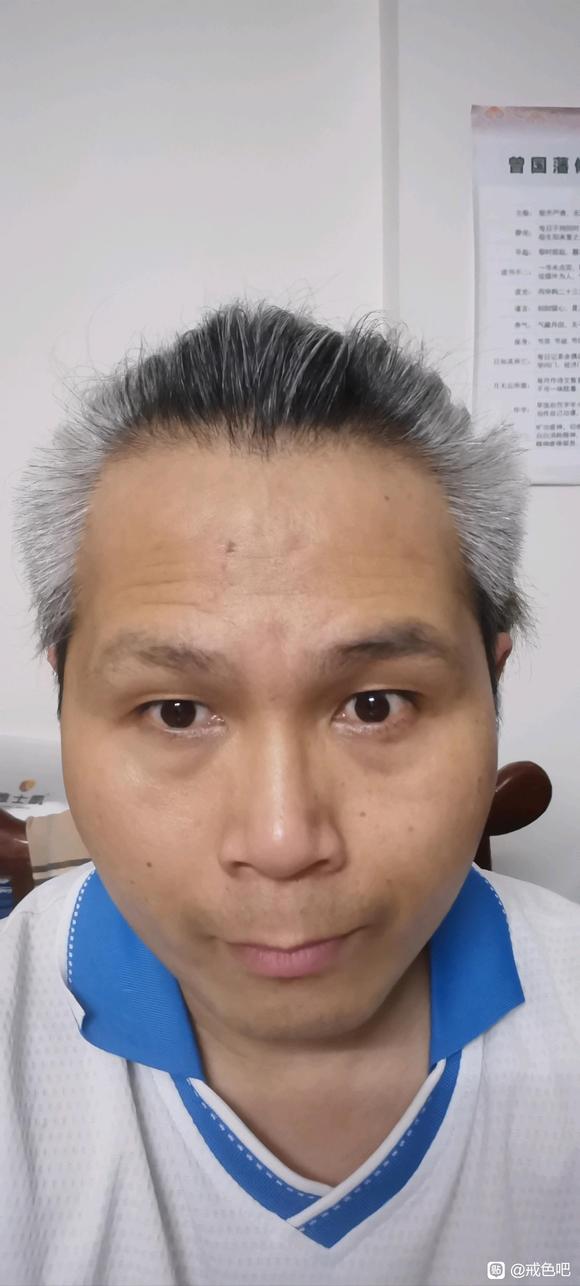 ”#微信看病卖药是假的#37岁大叔，重新开始，第19天