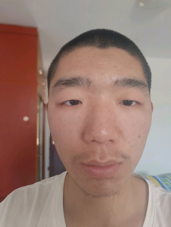 ”求分享点护肤知识，草莓鼻如何恢复啊？目前戒色13天，在寺院，