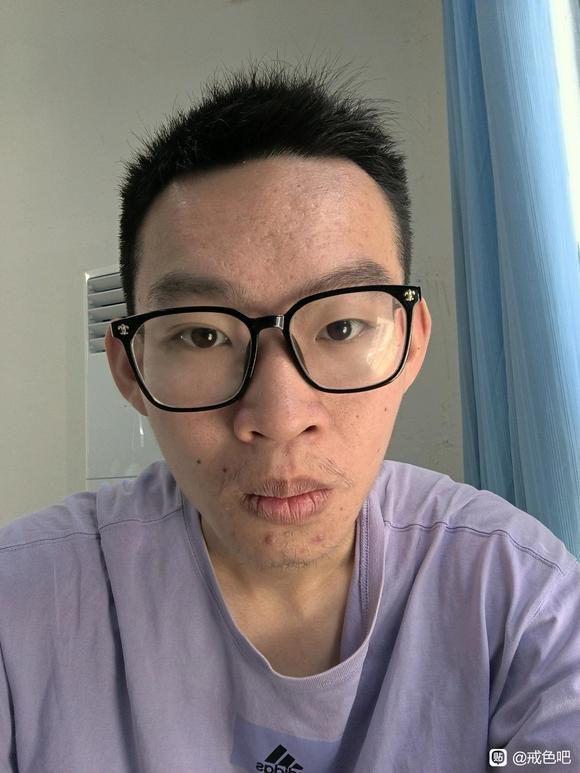 ”总是因为自己的长相自卑