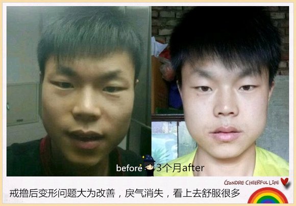 ”戒色成功对比图，变化很大，值得学习