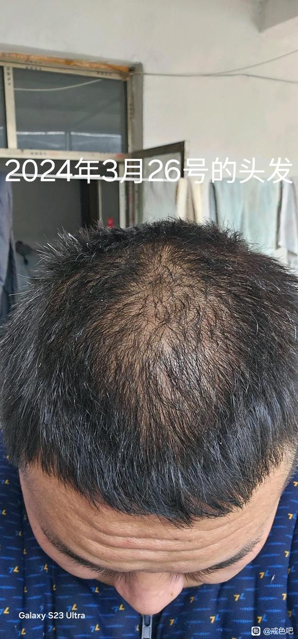 ”戒色真的可以长头发