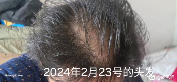 ”戒色真的可以长头发