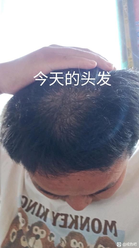 ”戒色真的可以长头发