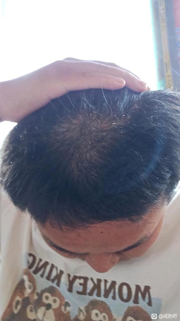 ”戒色真的可以长头发