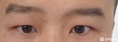 ”我用三个月证明:“眼睛是心灵的窗户”