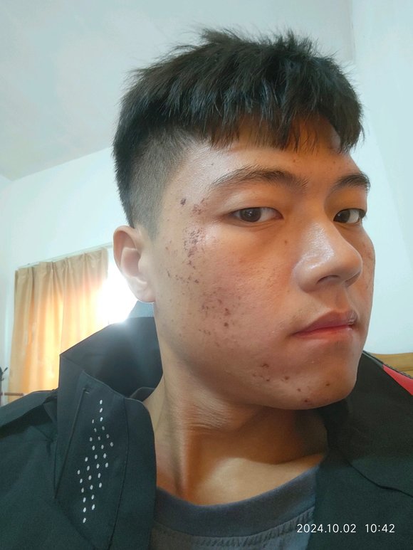 ”戒色45天后，好起来了