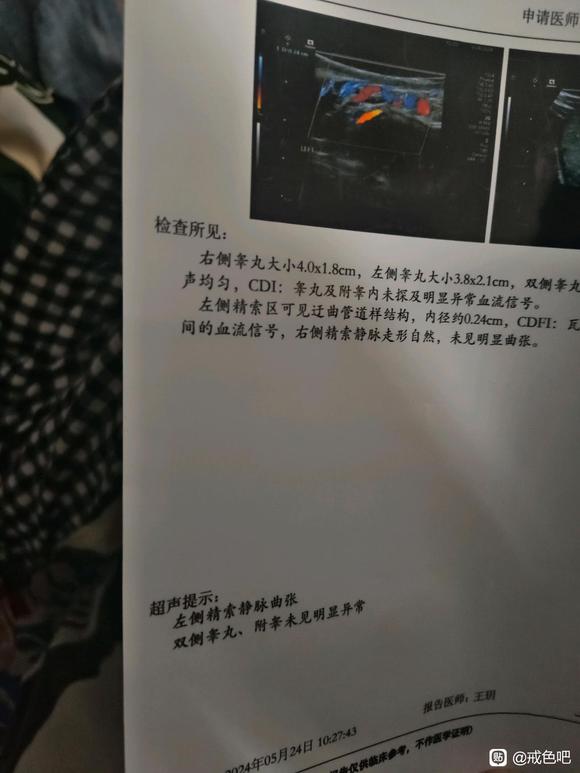 ”#微信看病卖药是假的#求救，轻度精索静脉曲张