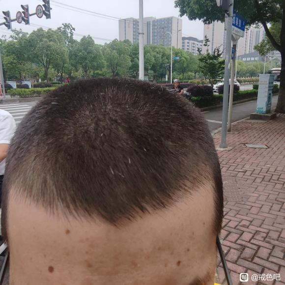 ”白头发还能恢复吗