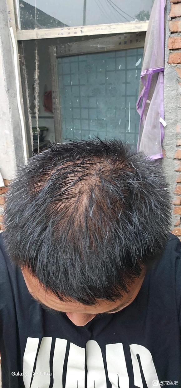 ”看看戒了差不多2个月左右