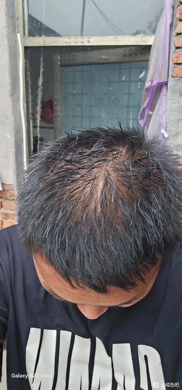 ”看看戒了差不多2个月左右