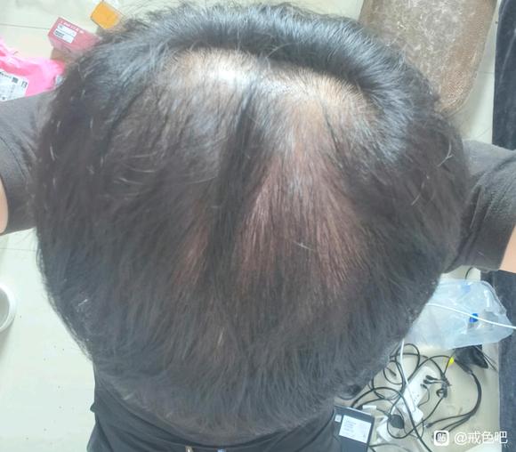 ”脱成这样了，我废了。