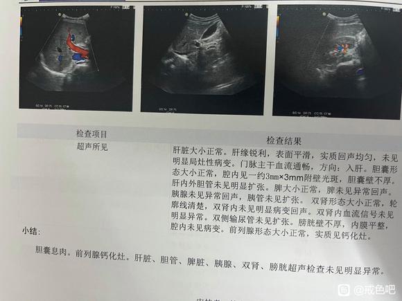 ”去体检了，体检报告出来了