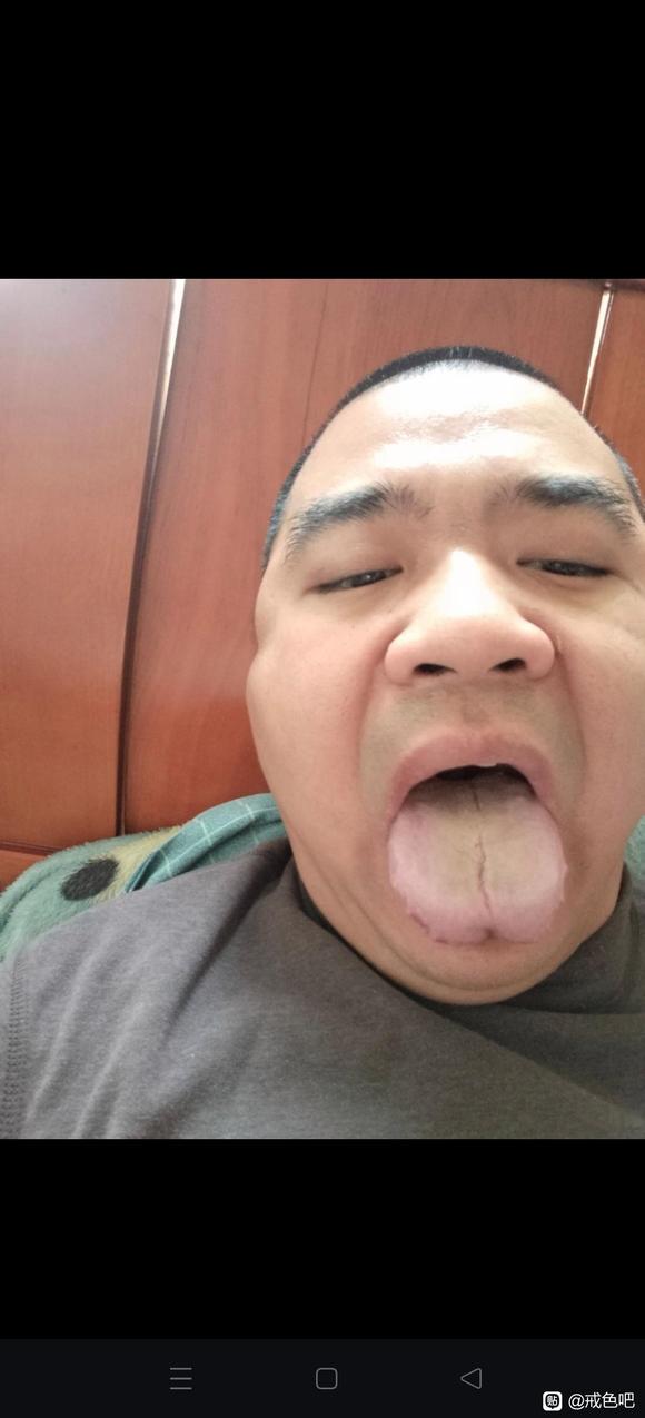 ”舌像调理三个月的变化