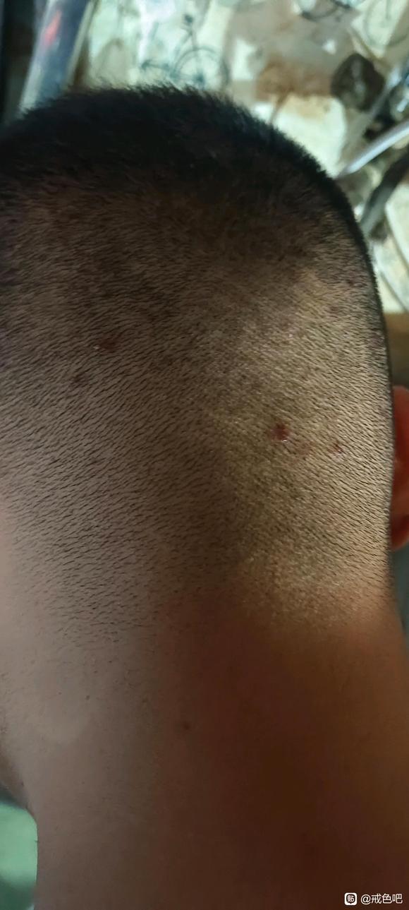 ”远离手瘾，远离黄源