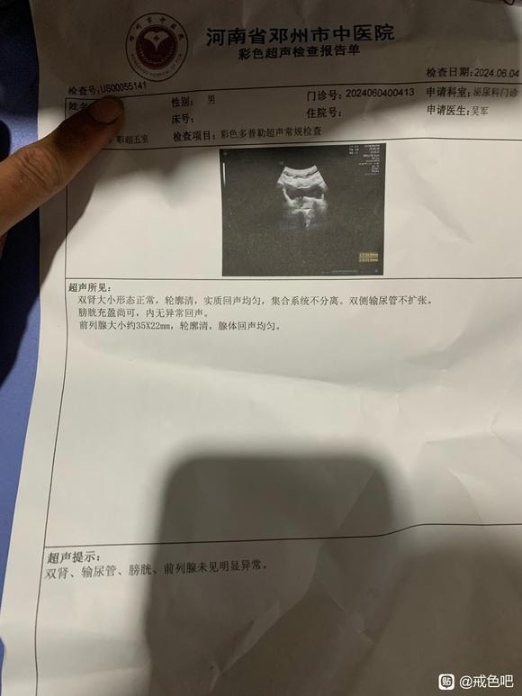 ”兄弟们别打了，我今天去医院检查了感觉没用