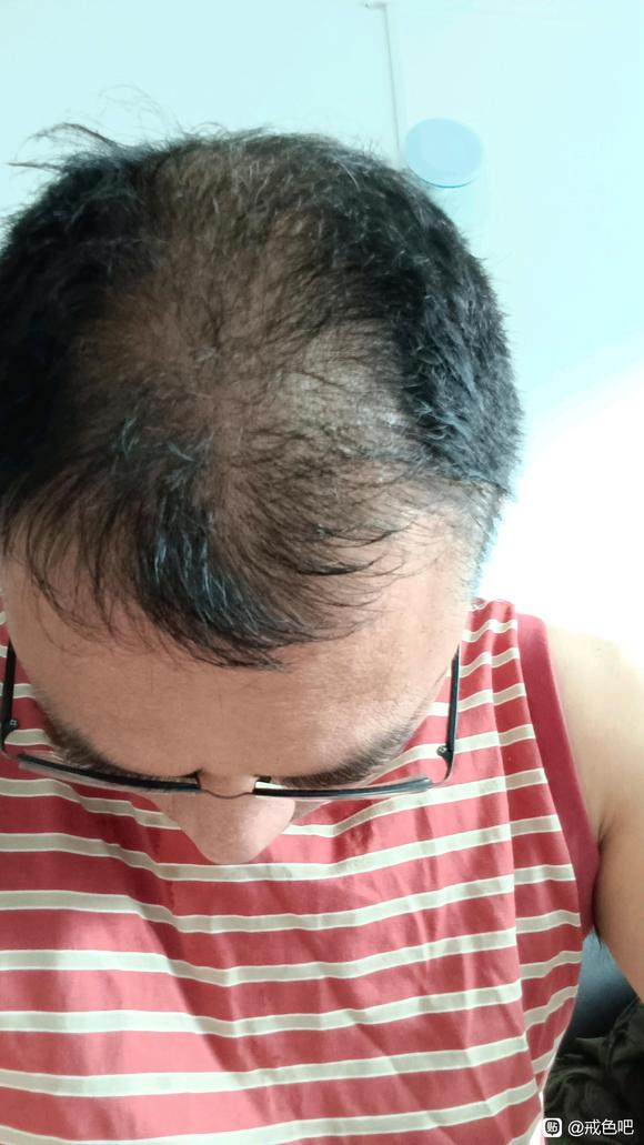 ”十八年的手艺活现在浑身无力